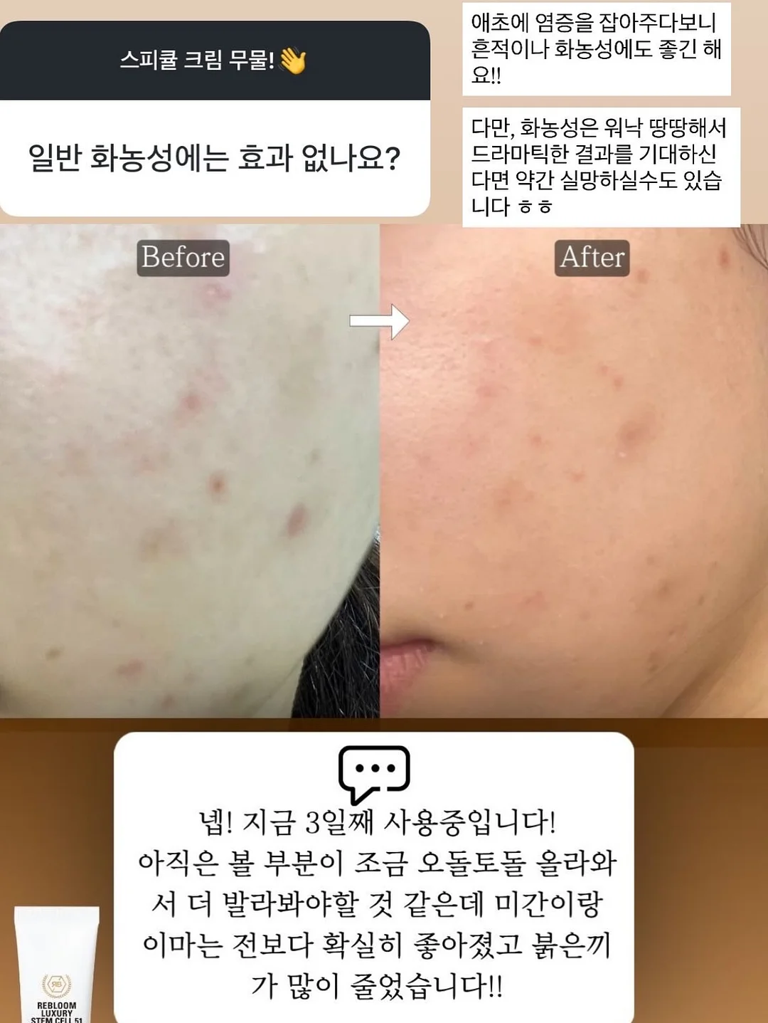 40대 다이어트 1