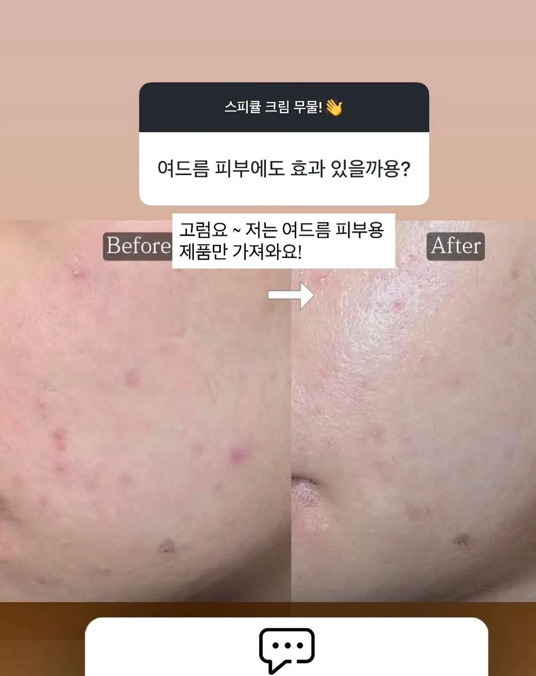 40대 다이어트 3