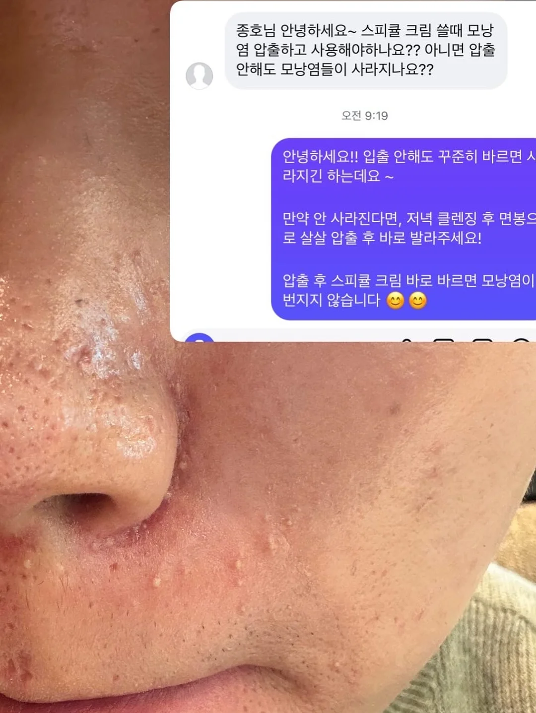 40대 다이어트 5
