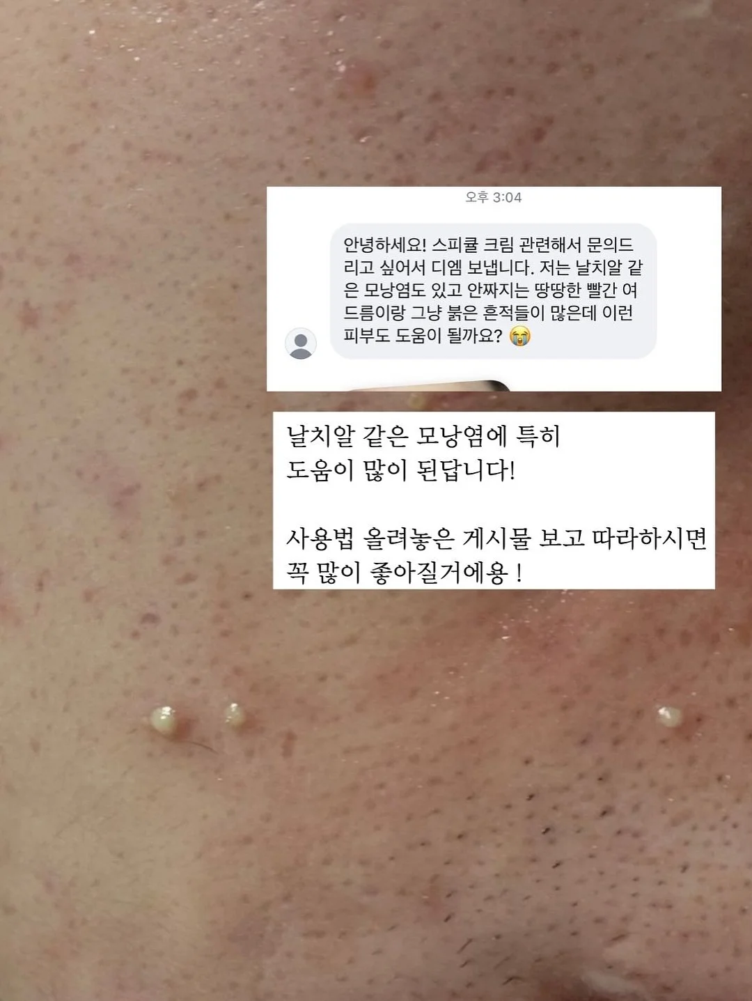 40대 다이어트 6