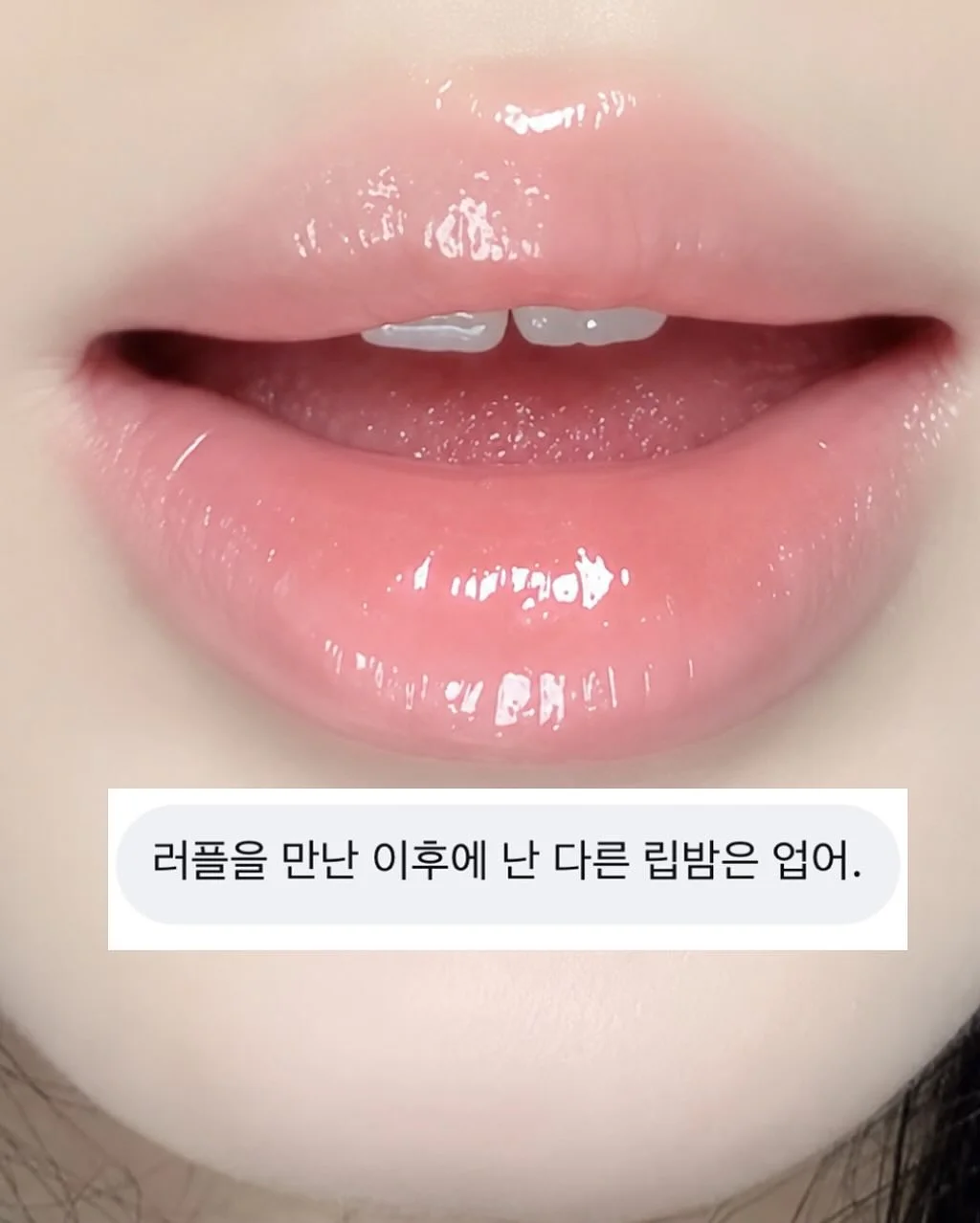 프로실 플러스 흉터스틱 1