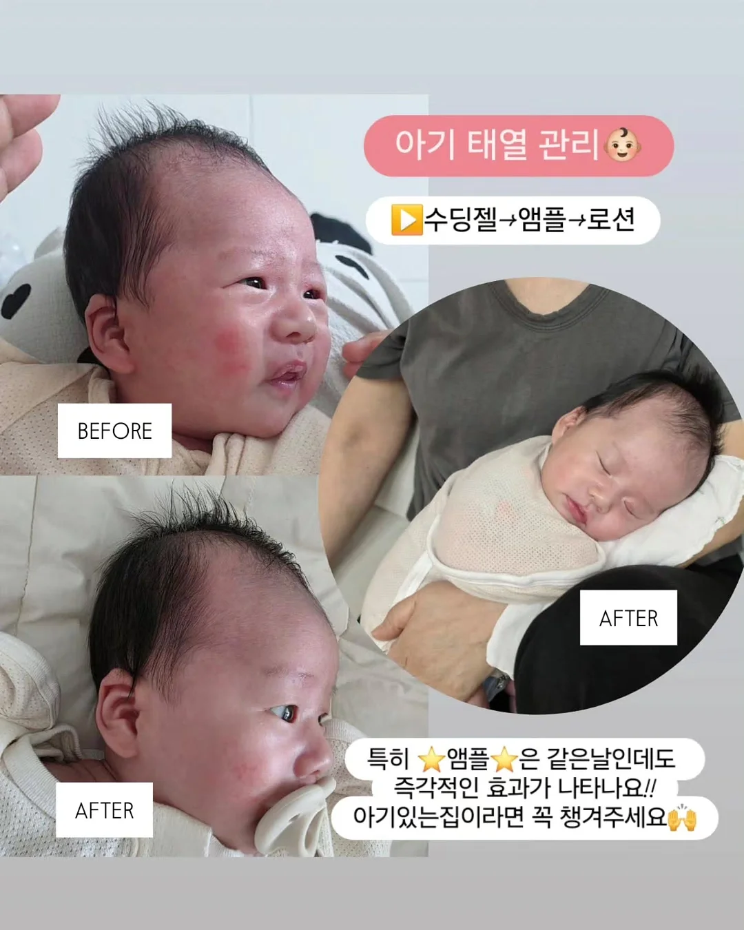 내추럴발란스 사료 2