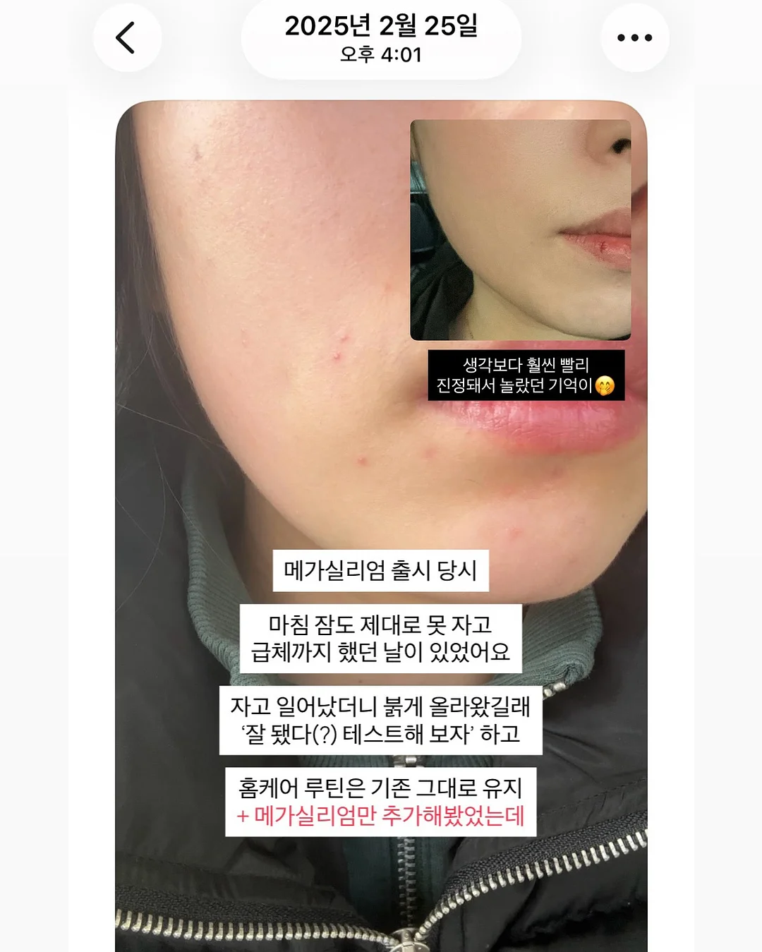 슈로스도어 6