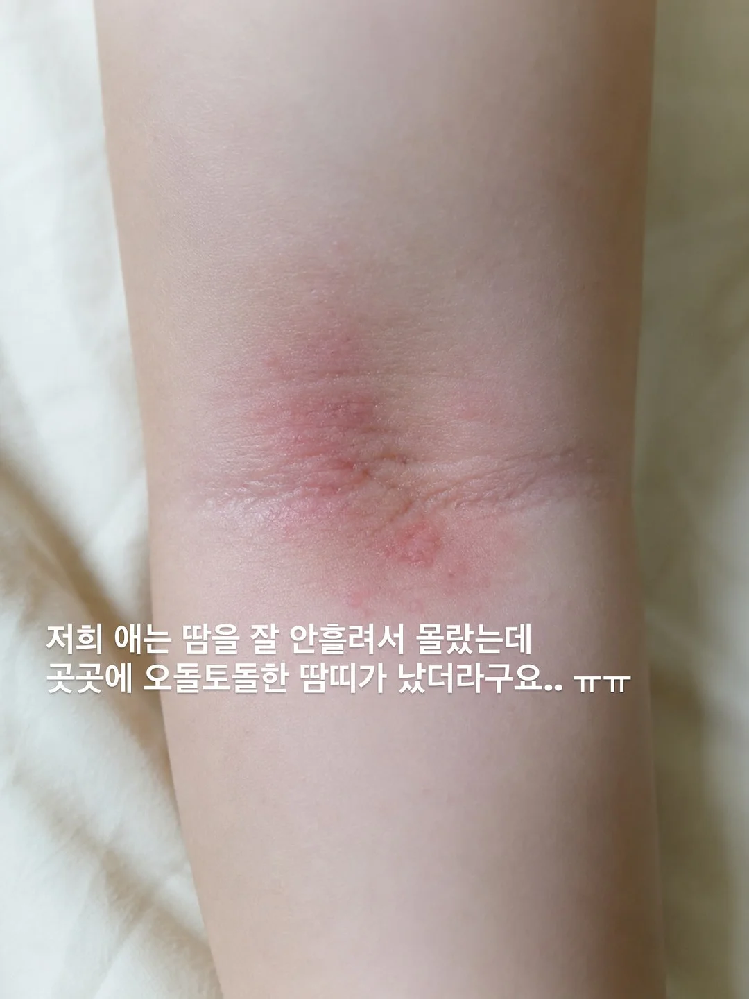 비법재료 2