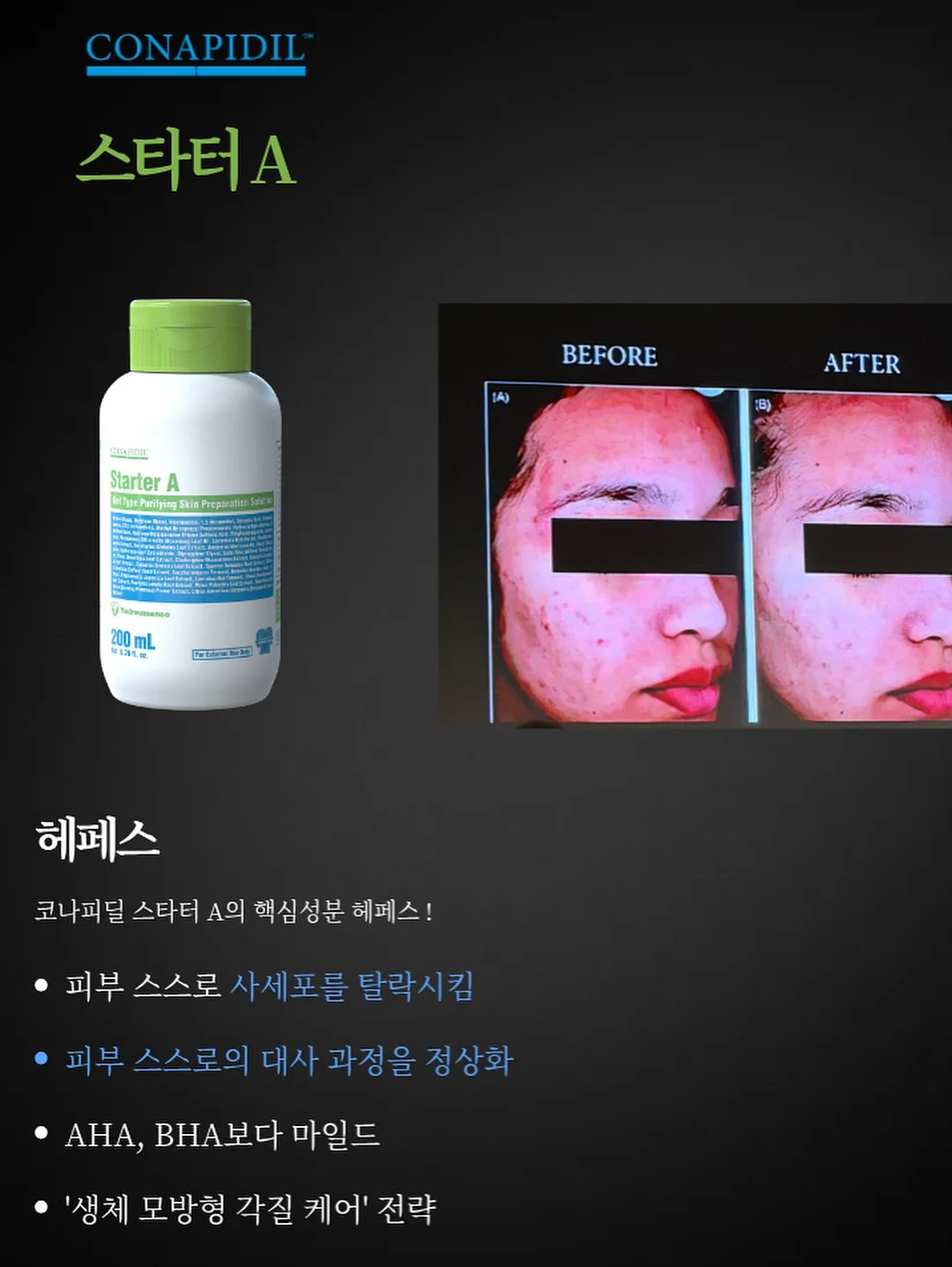 리즈셔츠 9