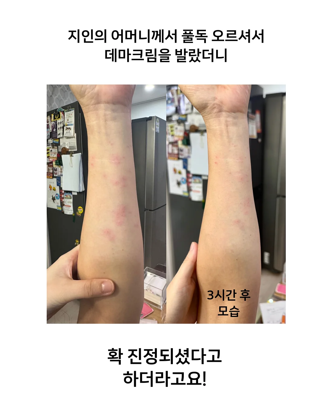 비엔드 쿨링 클라이밍 스커트 19