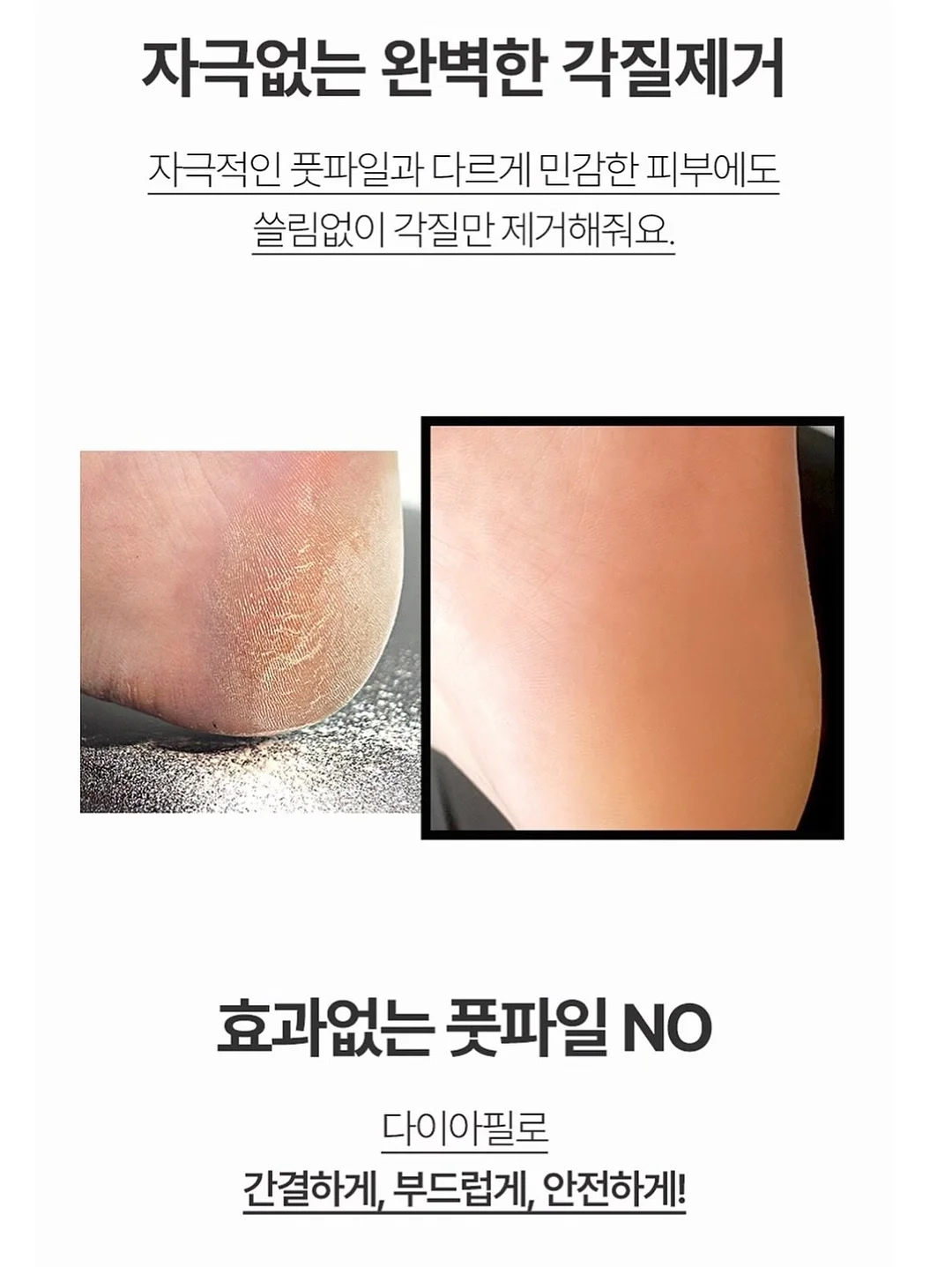 키치 코디 세트 2