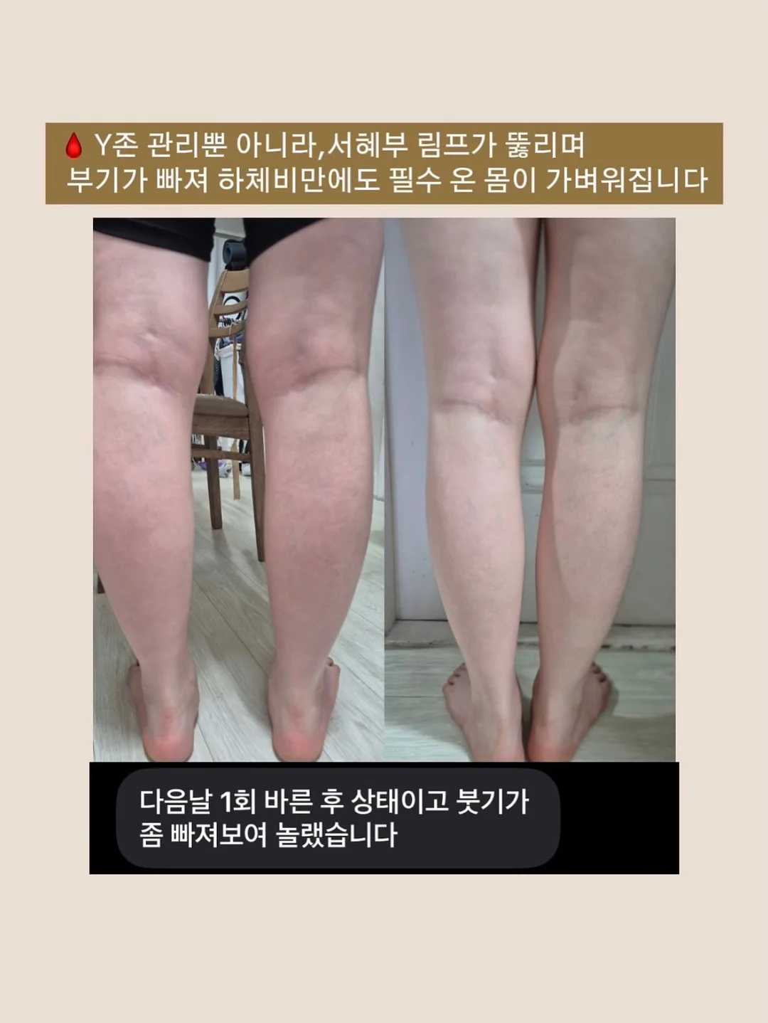 손톱 강화 코팅제 5