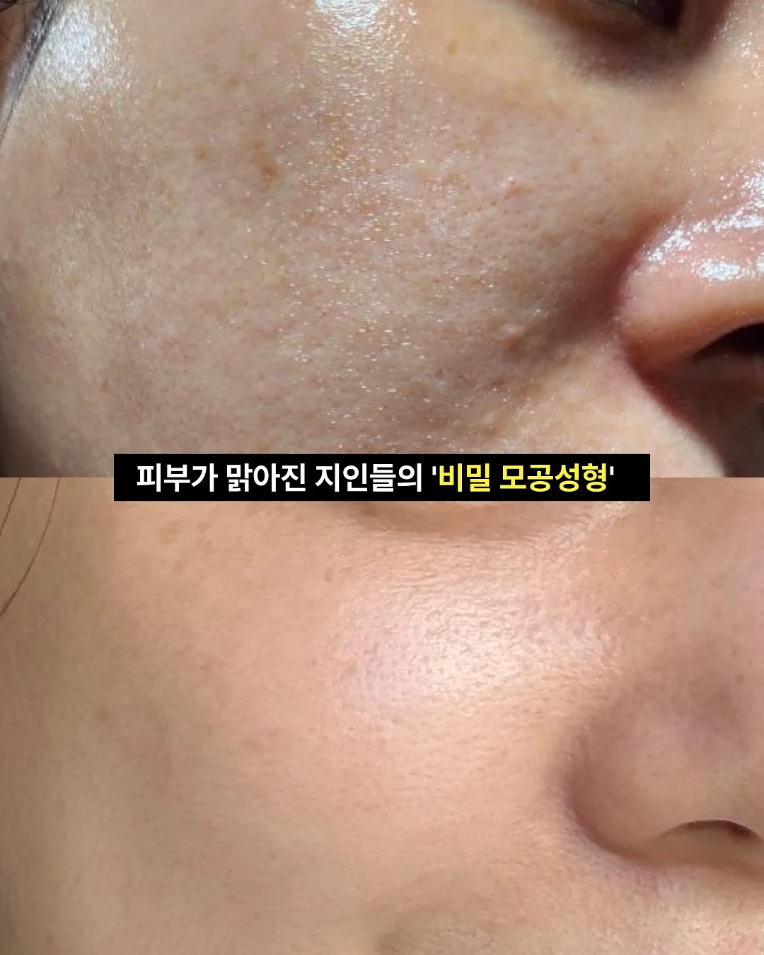 엘엠씨 워싱 블랙컬러 실리콘 패치로고 데님 트러커 자켓 17