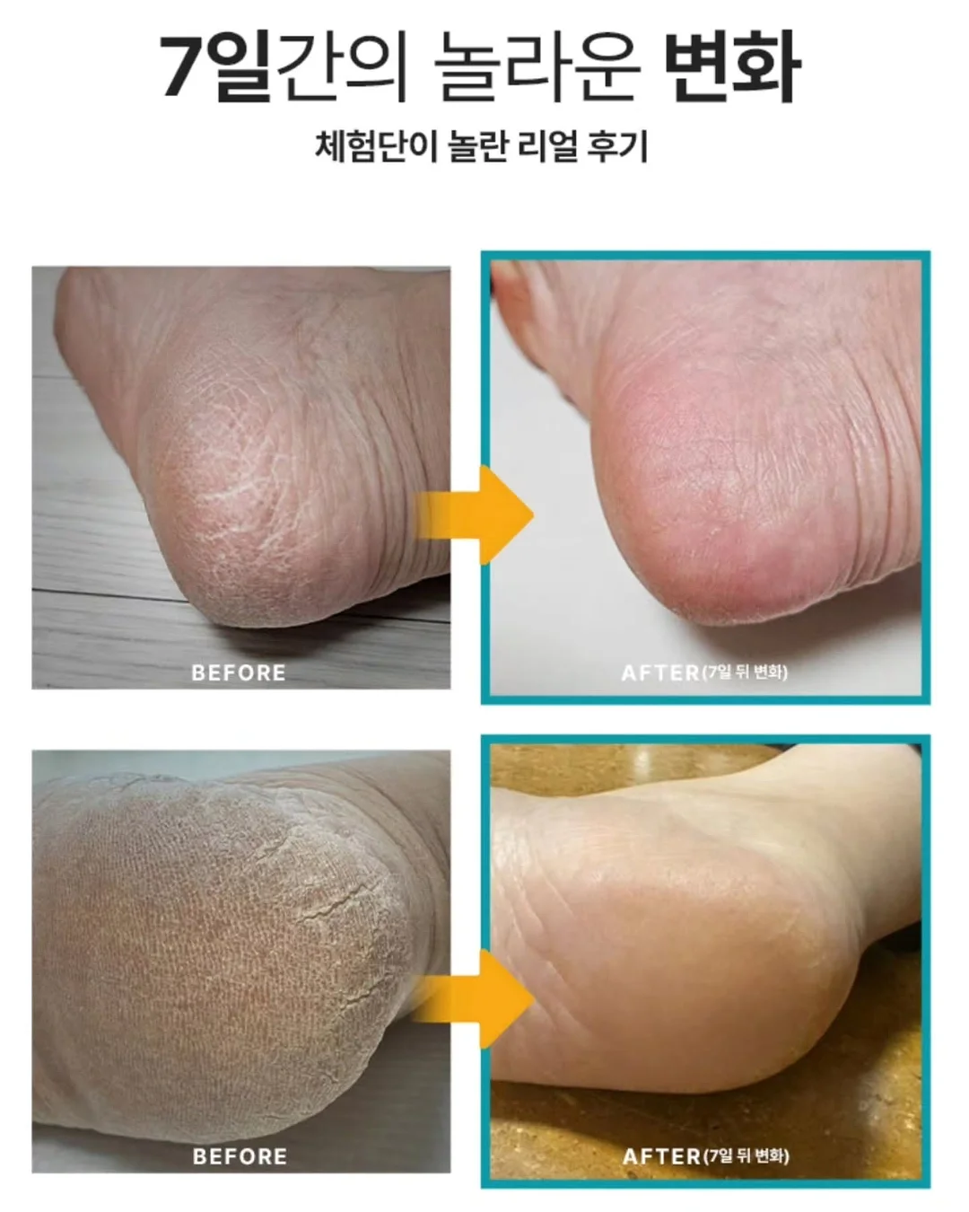 부부의날 현수막 3