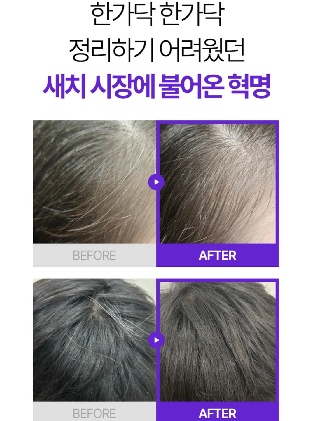 유산균 4