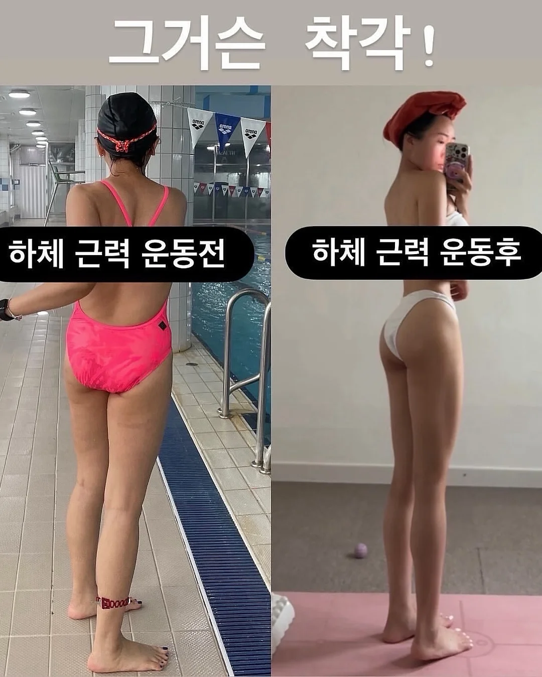 브이쎄라 EMS 중주파 피부관리기 2