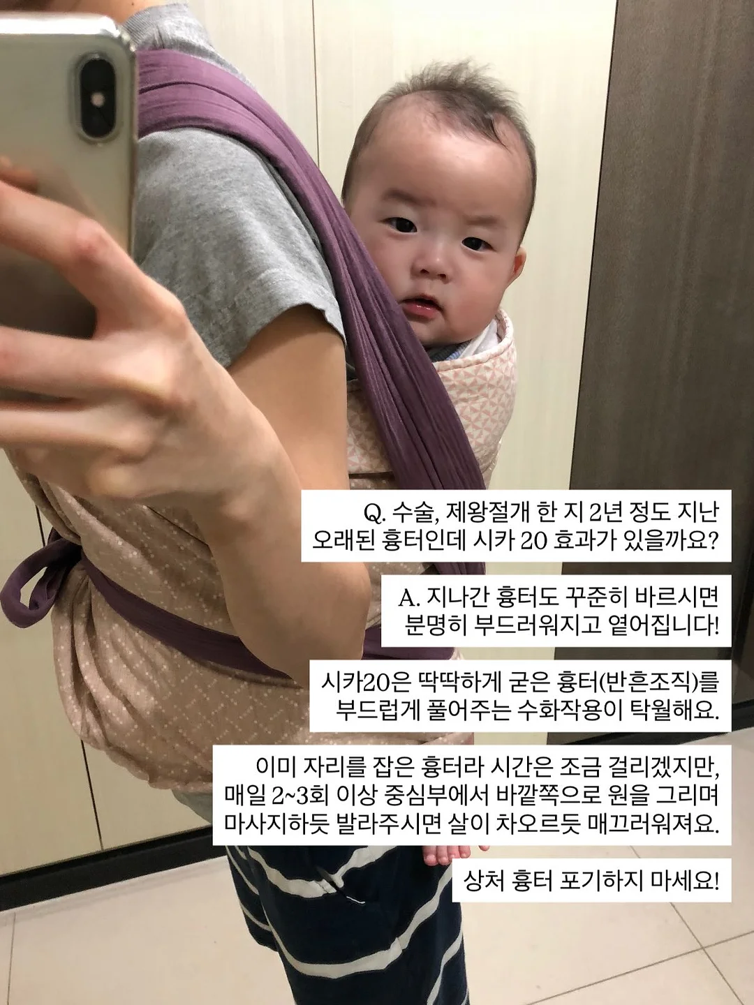 기본 버뮤다 팬츠 1