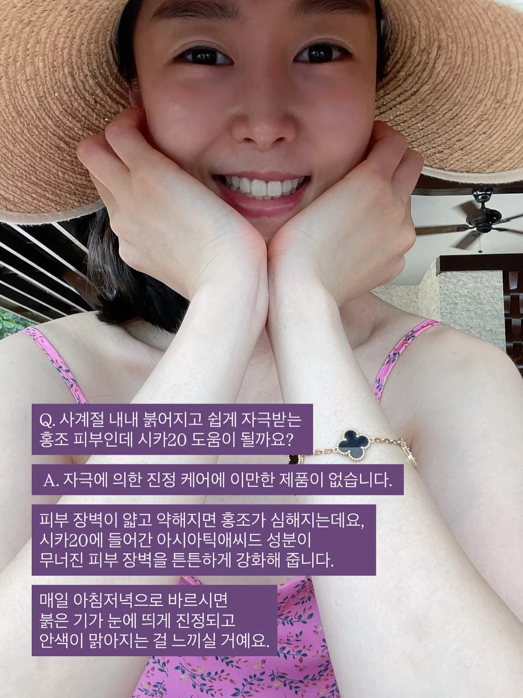기본 버뮤다 팬츠 11