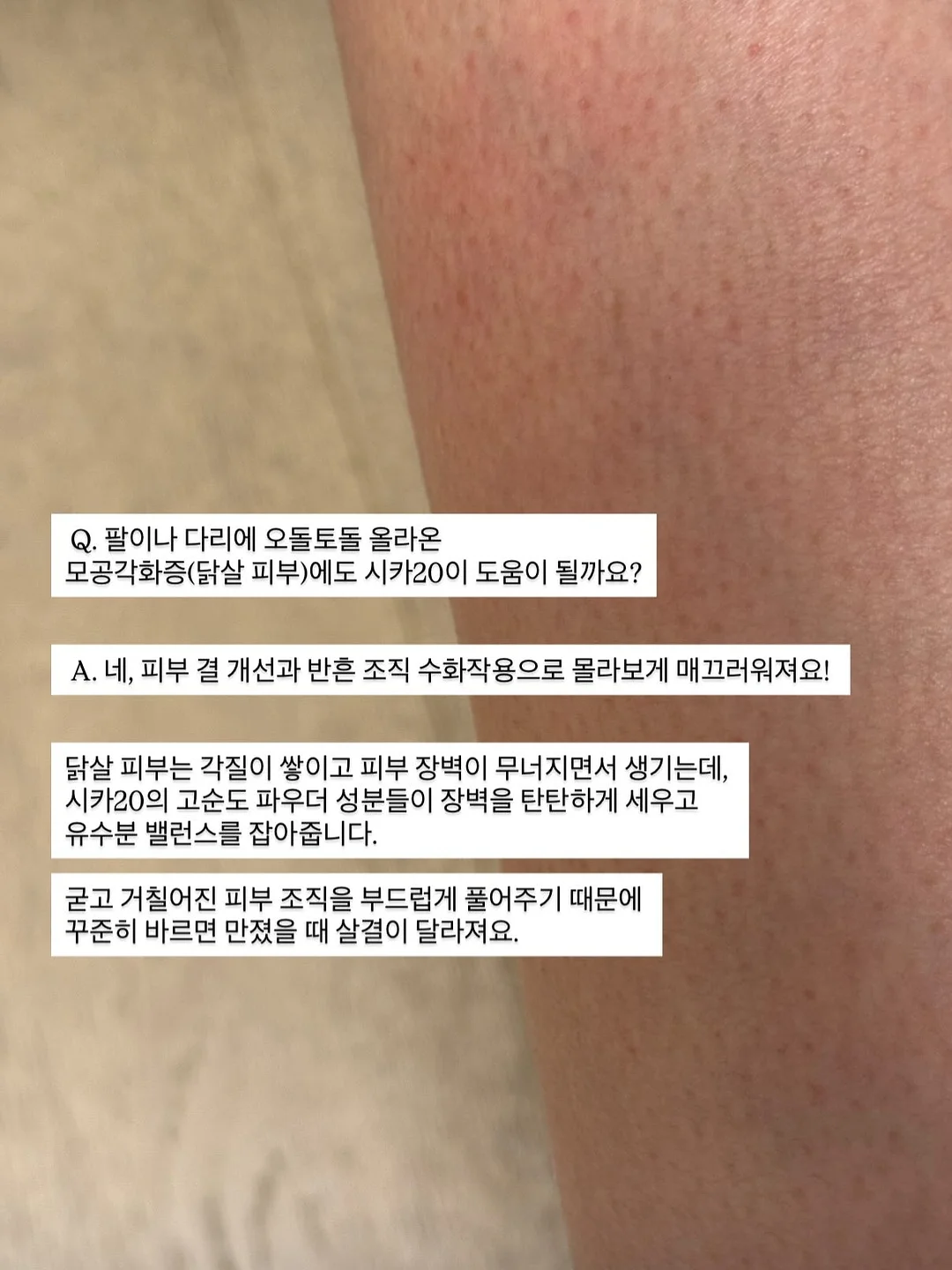 기본 버뮤다 팬츠 3