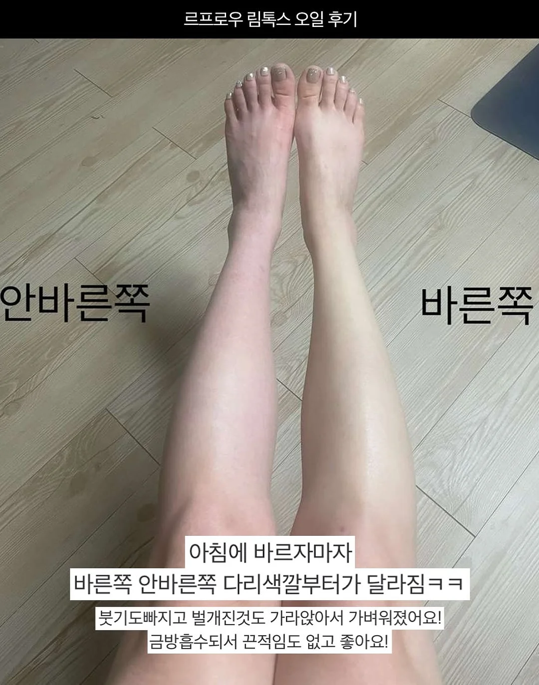 수입 고퀄라인 13