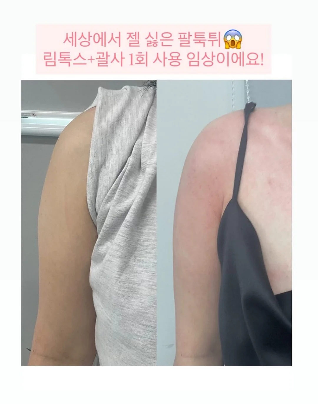 수입 고퀄라인 2