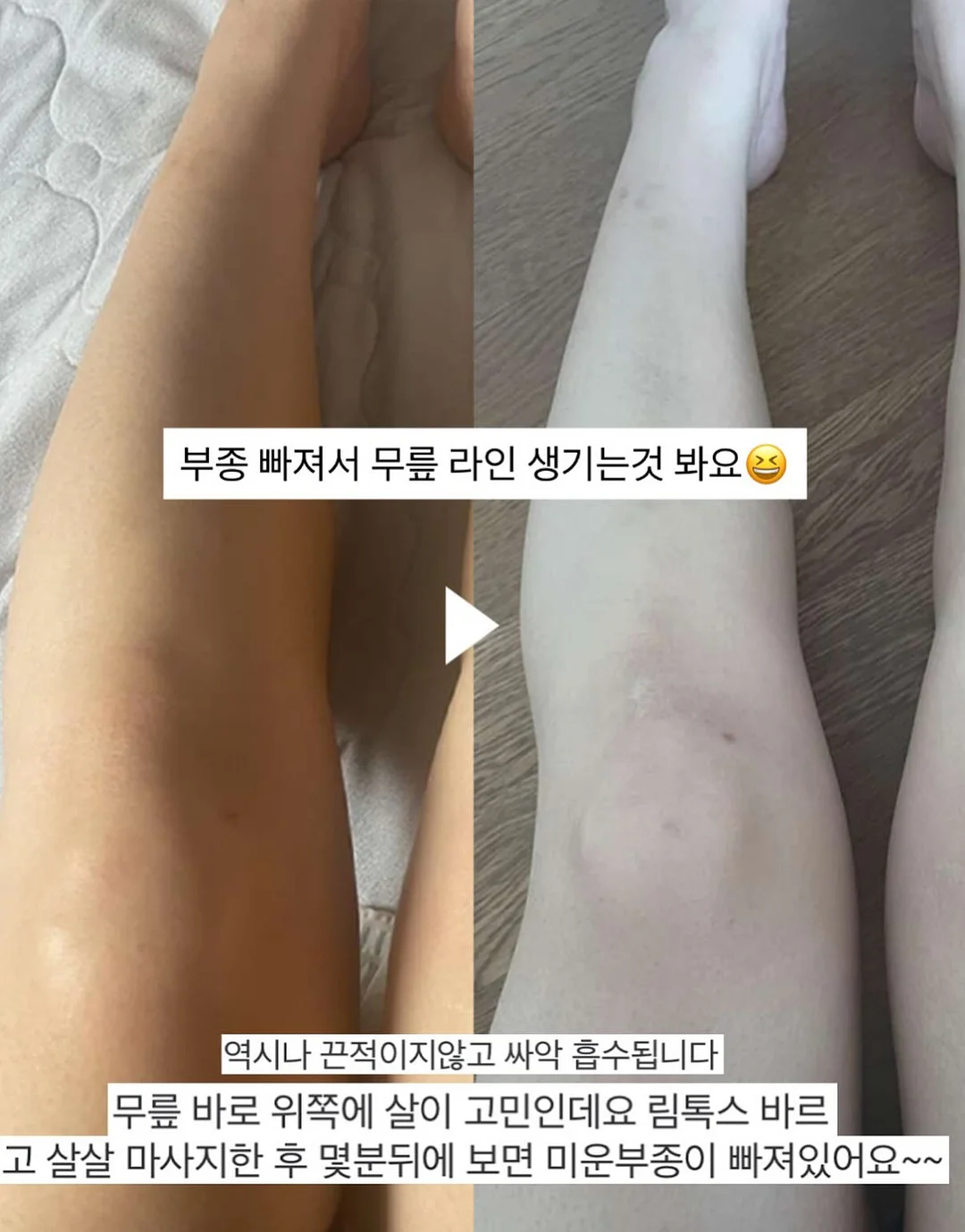수입 고퀄라인 9