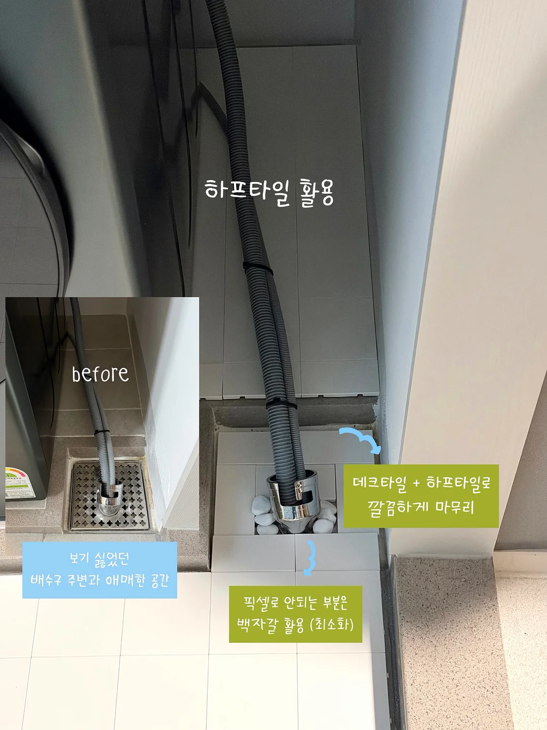 스킨젝션 MTS 12
