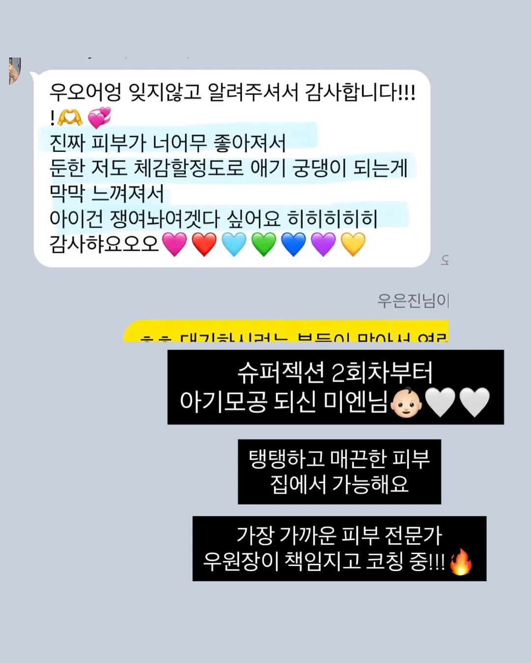 린넨 원피스 6
