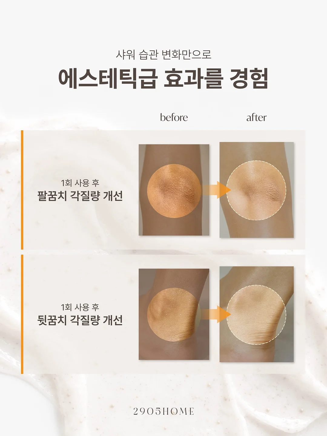 얼음붕대 12