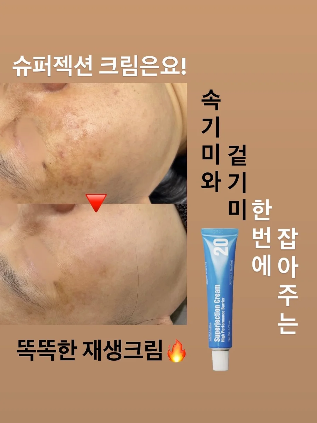 리버시블 앞치마 3