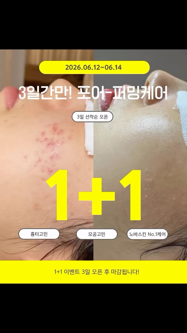 순금 적금