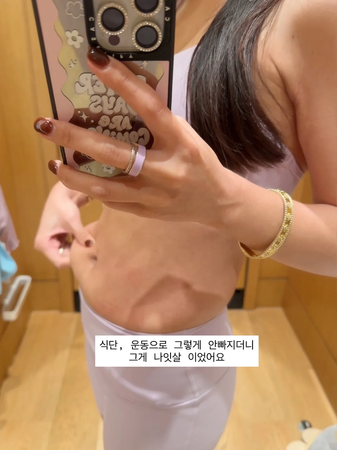 솔닥 비대면진료 보습제 5