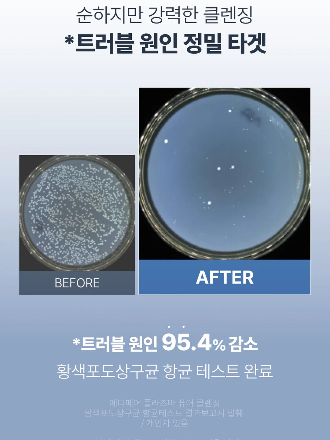 아일렛 블라우스 11