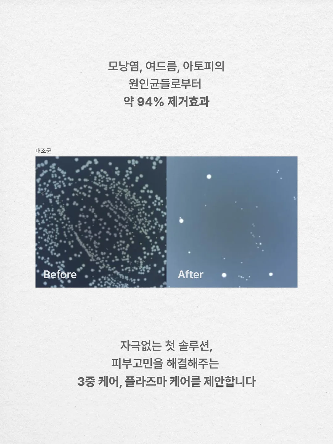 아일렛 블라우스 5