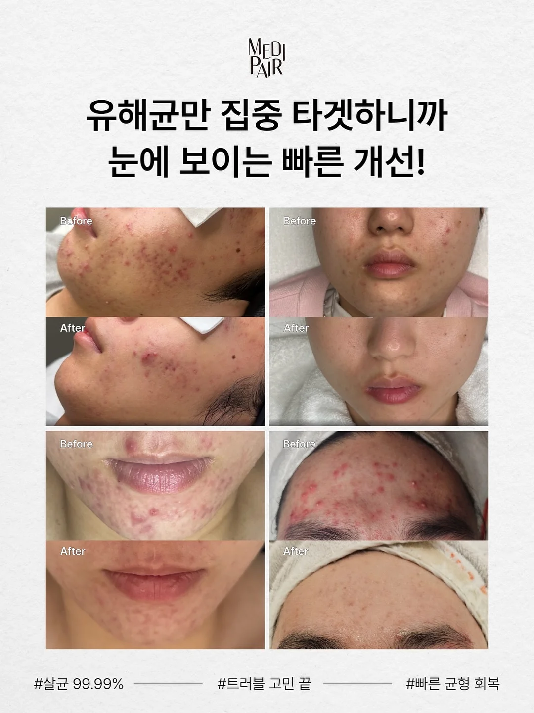 아일렛 블라우스 6