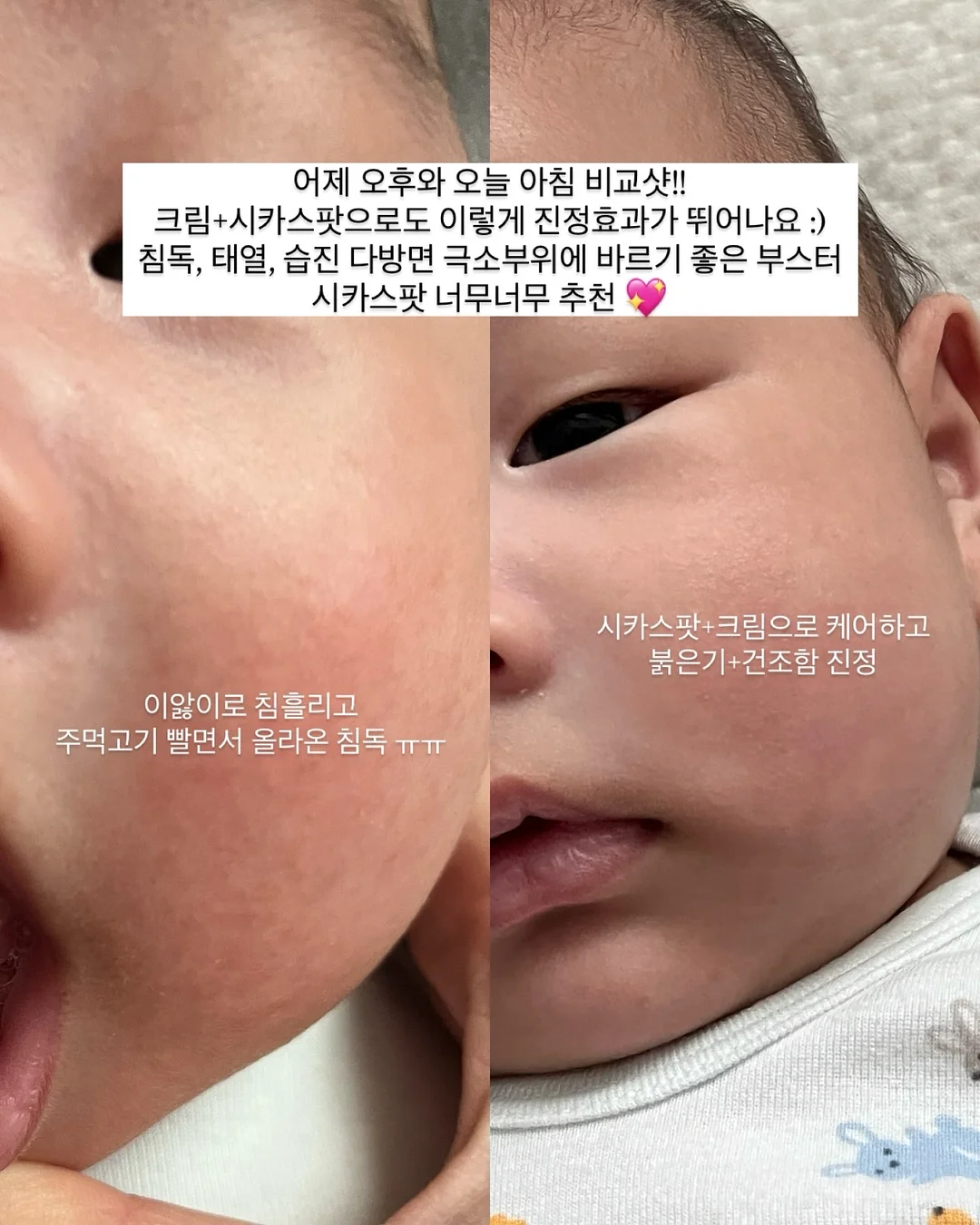 히얼아이엠 비비드나시, 구름블루머 3