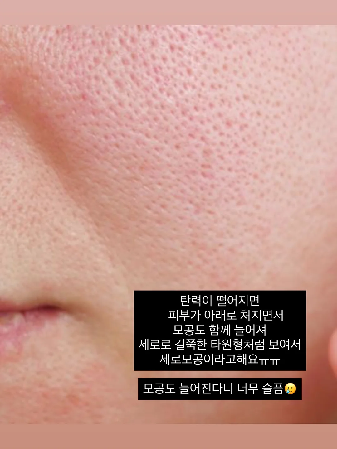 바테킨 프로젝트 3