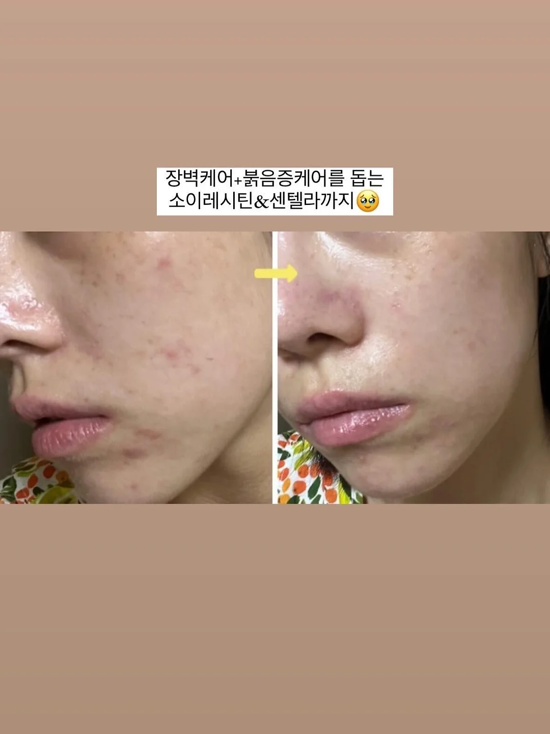 접시 정리대 10