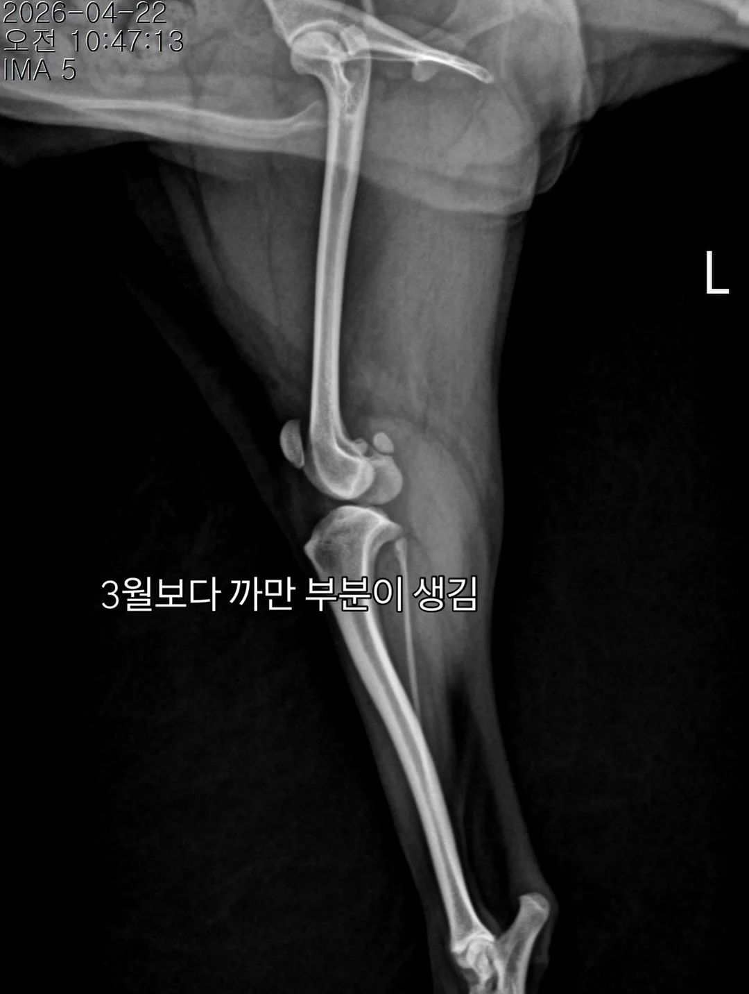 복직근이개 회복 산후복대 4