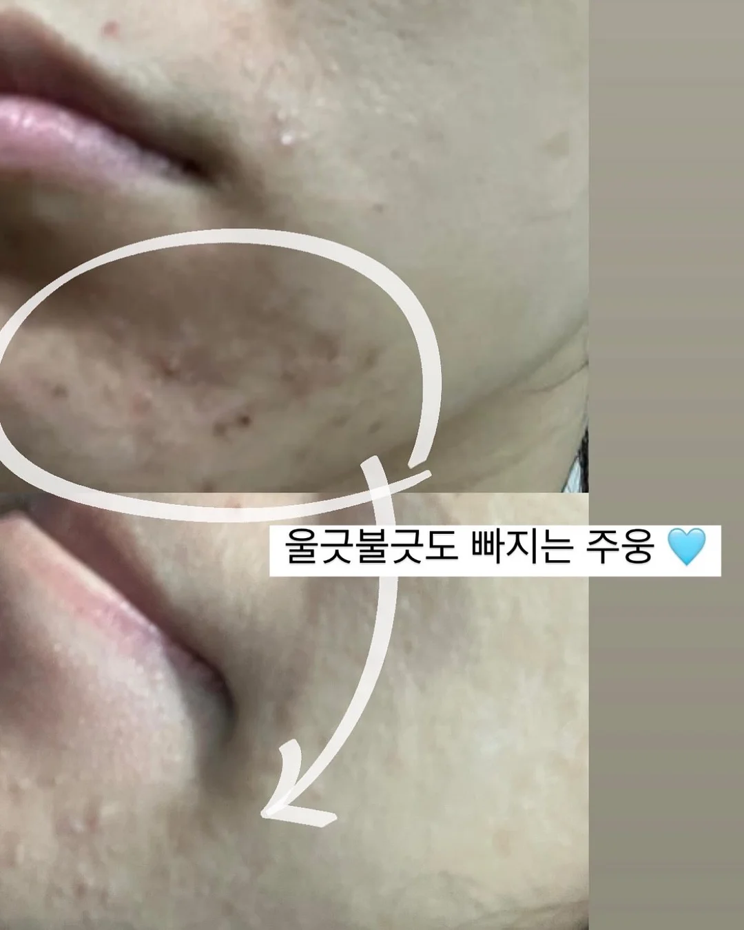 마스케라 썬캡 & 버킷햇 4