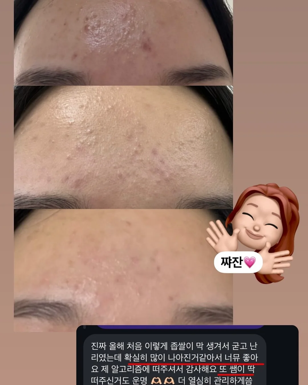 마스케라 썬캡 & 버킷햇 6