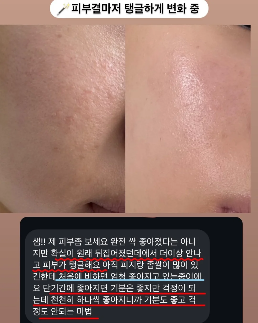 마스케라 썬캡 & 버킷햇 7