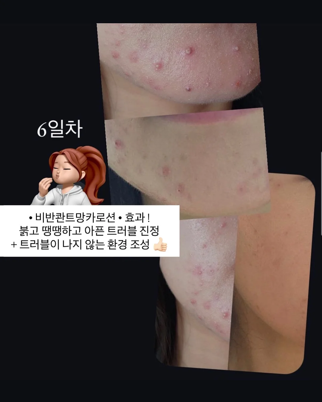 마스케라 썬캡 & 버킷햇 8