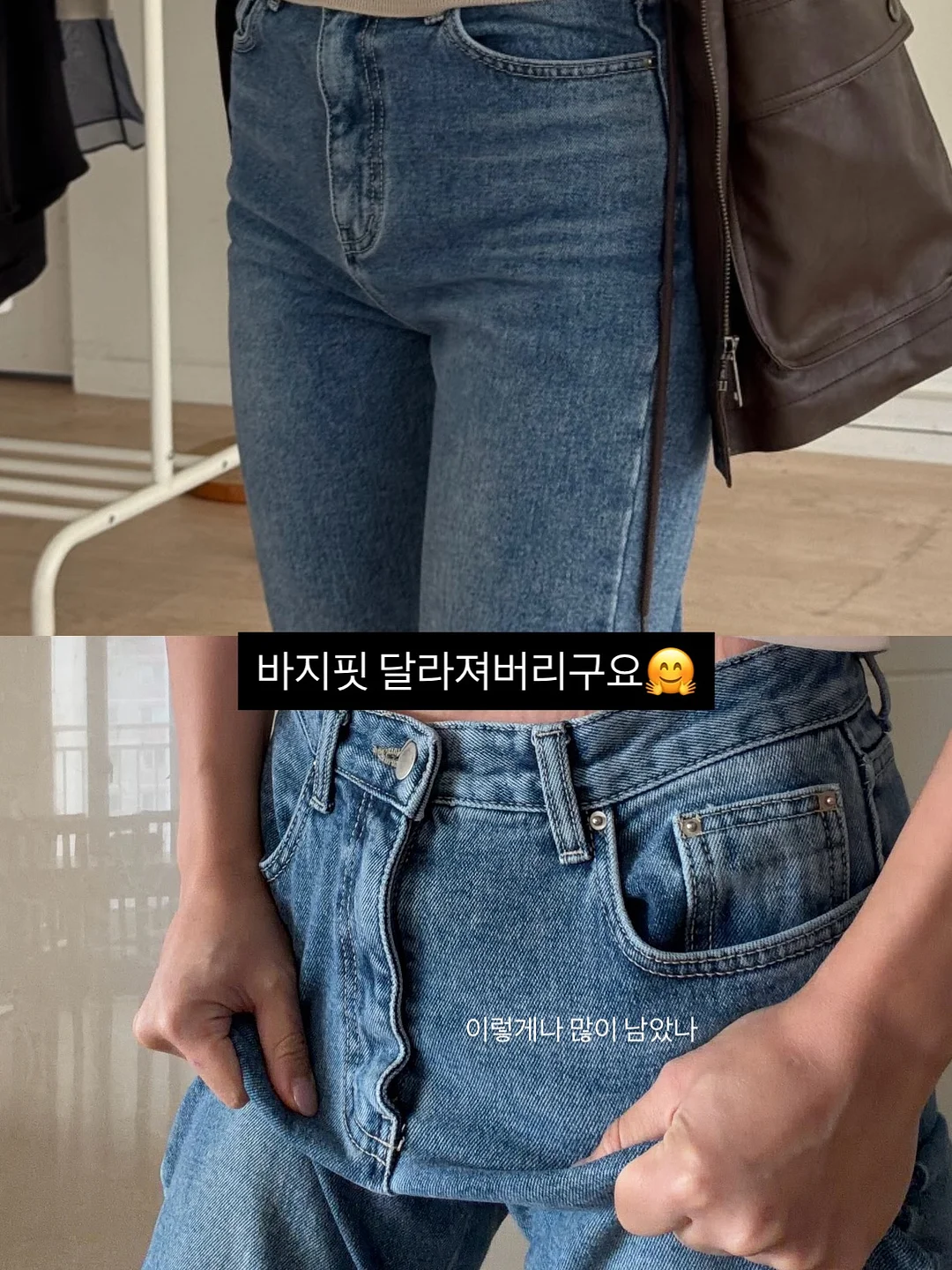 얼굴소멸리프팅 5