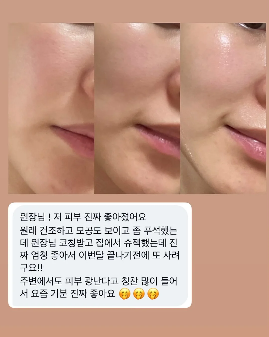 발코니 화분 스탠드 거치대 6