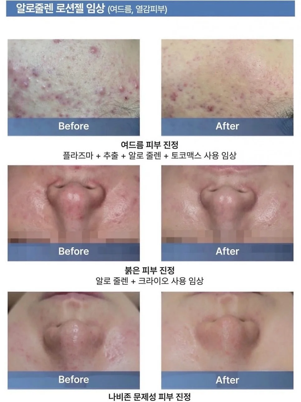 인절미꿔바로우 & 두반장계란장조림 & 숙주홍고추무침 & 오징어백짬뽕 2