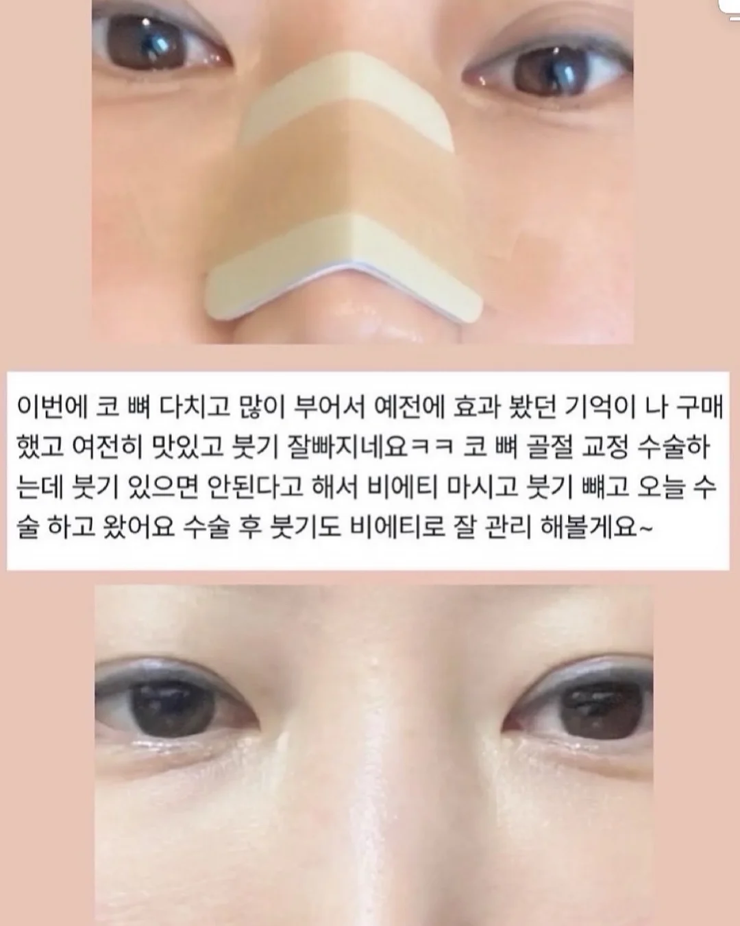 에르띠 톤업재생크림 5