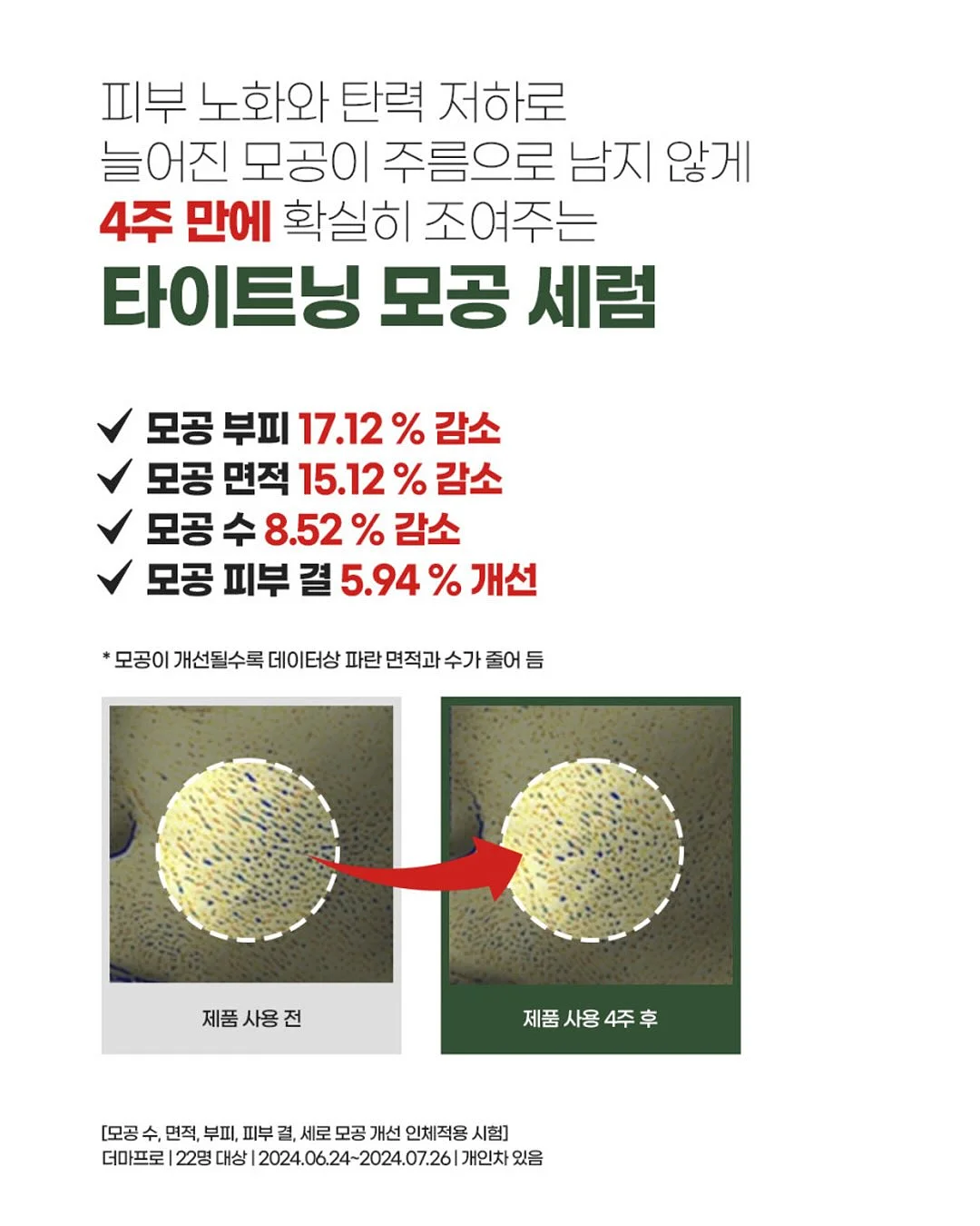 와퍼베베 세트 13