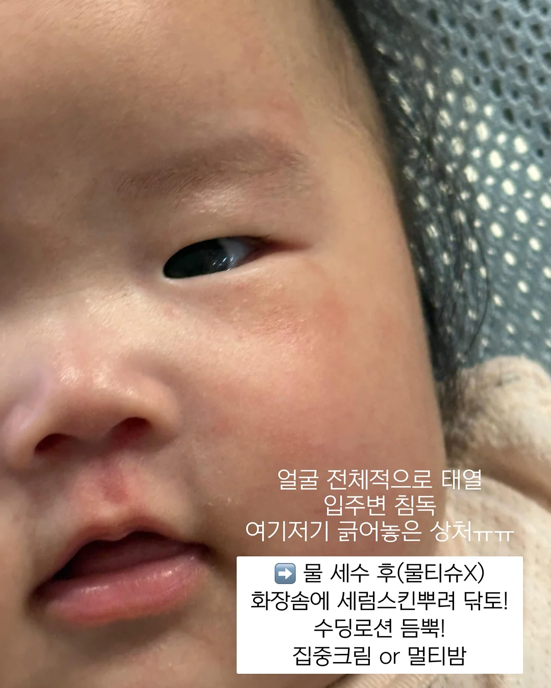 노아 셋업 12
