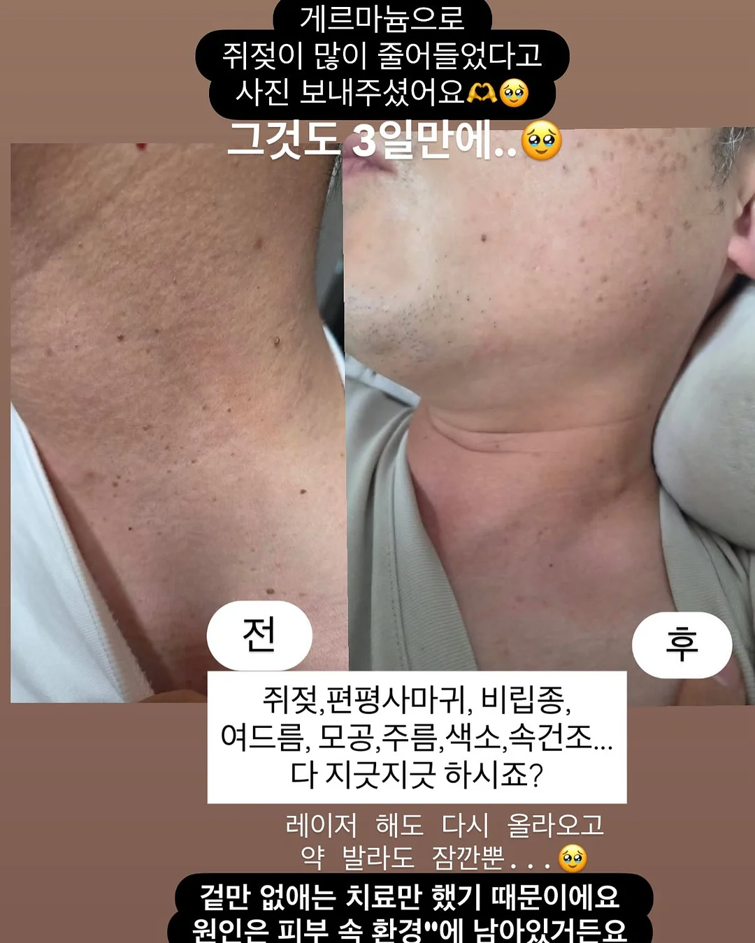 양념통 수납 정리대 4