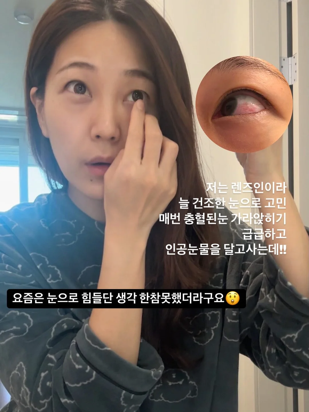 베이비라군 네일팁 14