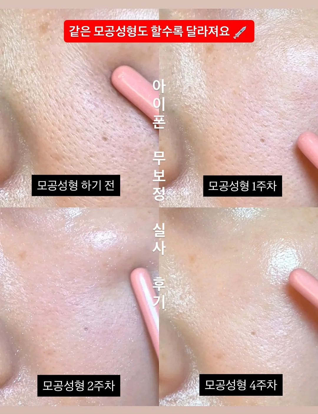 델리비 자체제작 랩 반바지 2