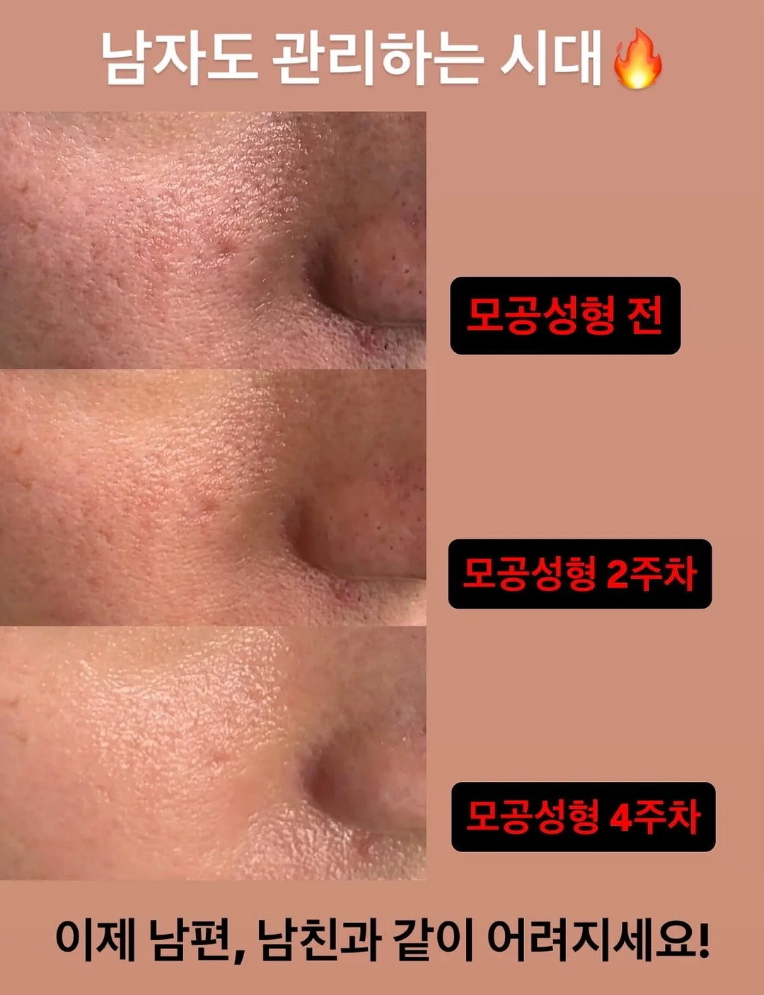 델리비 자체제작 랩 반바지 3