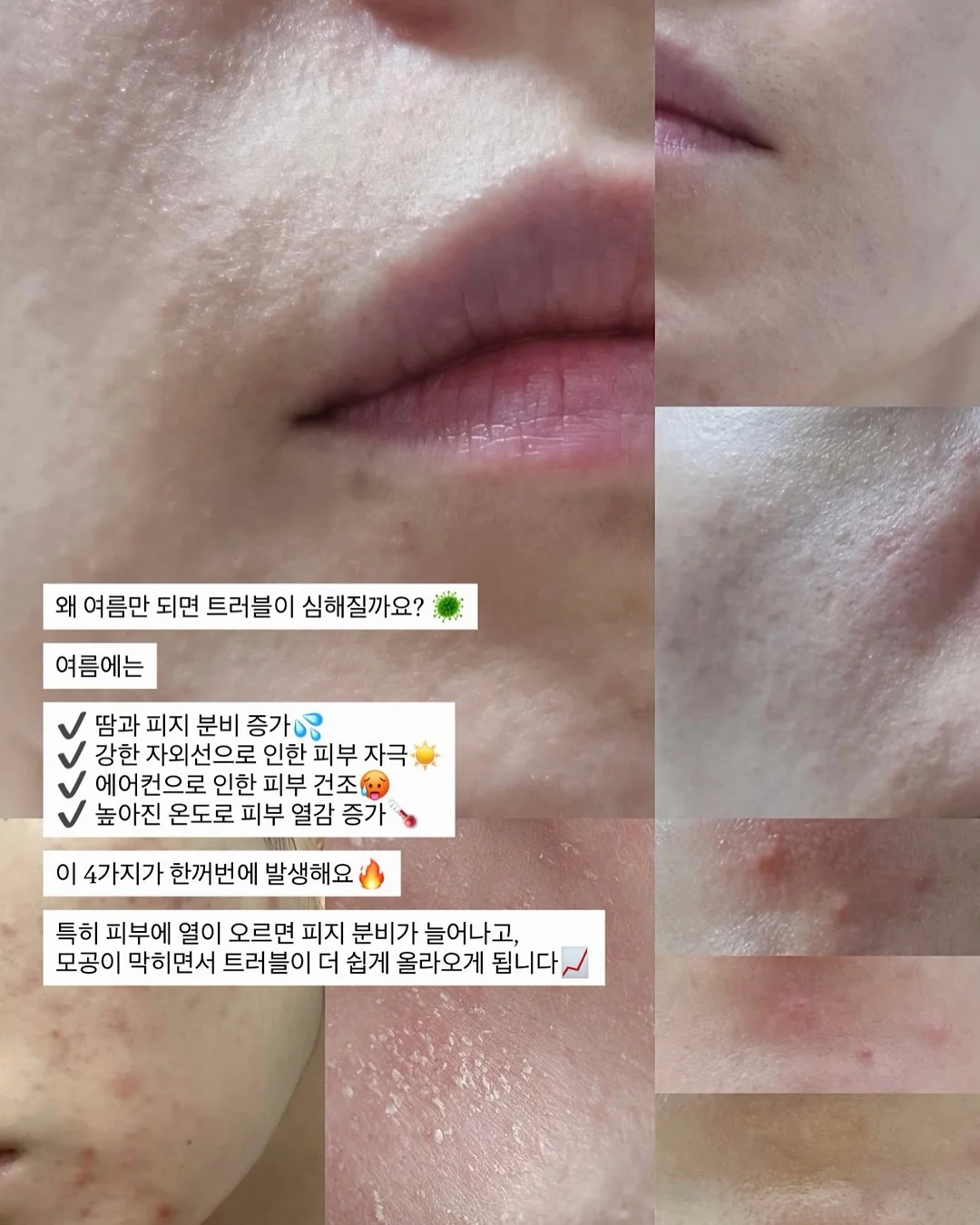 차일드라이프 멀티비타민&미네랄 2